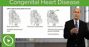 Congenital Heart Disease – Cardiology | Lecturio