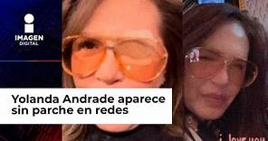 Yolanda Andrade aparece en redes sociales sin parche en el ojo; fans se alegran