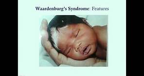 Waardenburg's Syndrome - CRASH! Medical Review Series