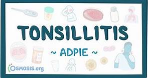Tonsillitis: Nursing Process (ADPIE)