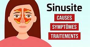 Sinusite : causes, symptômes et traitements - Index Santé