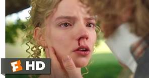 EMMA (2020) - Love and Nosebleeds Scene (8/10) | Movieclips