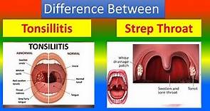 Difference between Tonsillitis and Strep Throat