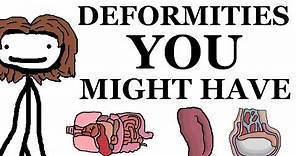 Deformities That You Might Have