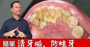 (牙齒3)天然自助清牙垢！怎樣預防蛀牙？柏格醫生 Dr Berg