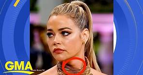 Denise Richards treats an enlarged thyroid after fans noticed it on TV l GMA