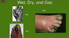 gangrene (dry , wet , gas gangrene) pathology