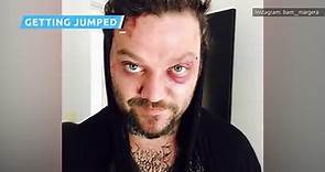 The Truth Behind Bam Margera's Wild Life