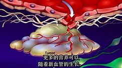 肿瘤生物学4：血管生成