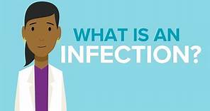 What is Infection | Cincinnati Children's