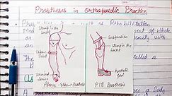 Prosthesis in Orthopaedic Practice - uses ,parts of prosthesis