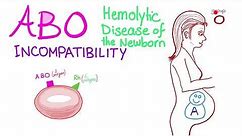 ABO Incompatibility And Hemolytic Disease Of The Newborn (HDN)