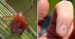 A sesame seed-sized tick is spreading across Missouri. Here's what to know