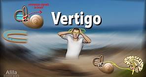 Vertigo: Causes, Pathophysiology and Treatments, Animation