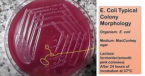 E coli typical colony morphology on Macconkey agar
