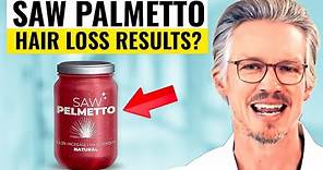 WHAT HAPPENED WHEN 381 PEOPLE TRIED SAW PALMETTO FOR HAIR LOSS - SEE THE SHOCKING RESULTS?