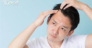 【改善脫髮】日本專家分享4類食物防脫髮　揭3類食品加劇掉髮 - 香港經濟日報 - TOPick - 健康 - 保健美顏