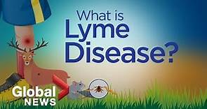 Why Lyme disease is on the rise, explained
