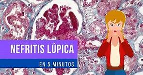 Nefritis Lúpica en 5 MINUTOS!!: Clasificación