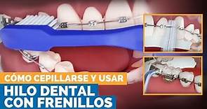 Cómo Cepillarse Y Usar Hilo Dental Con Frenos | Premier Orthodontics