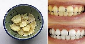 牙齒發黃不要花錢去洗牙！教你一個土方法，讓黃牙瞬間變白，完全沒有副作用！