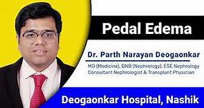 Know About Pedal Edema: Causes, Symptoms & Treatment By Nephrologist Dr. Parth Narayan Deogaonkar