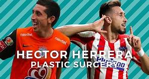 Hector Herrera's Plastic Surgery Transformation