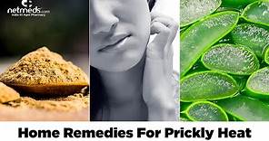 Prickly Heat: 5 Natural Remedies To Soothe Your Skin