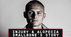 SMALLBONE'S STORY | Southampton youngster Will Smallbone on overcoming injury and alopecia