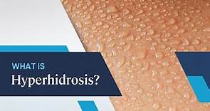 What is Hyperhidrosis?