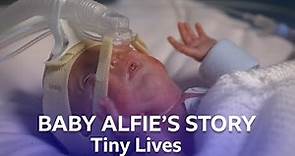 Premature Baby Alfie Arrives Three Months Early | Tiny Lives Series 2 | BBC Scotland
