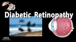 Retinopathy: Diabetic and Hypertensive, Animation.