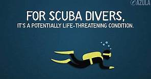 What Are “the Bends” in Scuba Diving? | Azula