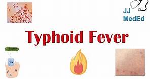 Typhoid Fever: Pathogenesis (vectors, bacteria), Symptoms, Diagnosis, Treatment, Vaccine