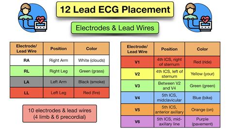 12 Lead Chart