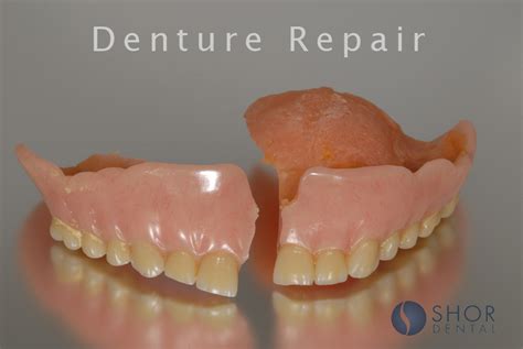 A K Dental Denture Repairs