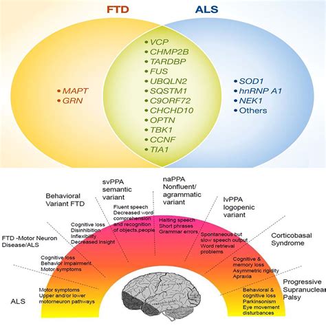 ASO Drug Targets ALS and FTD Neuronal Hyperexcitability