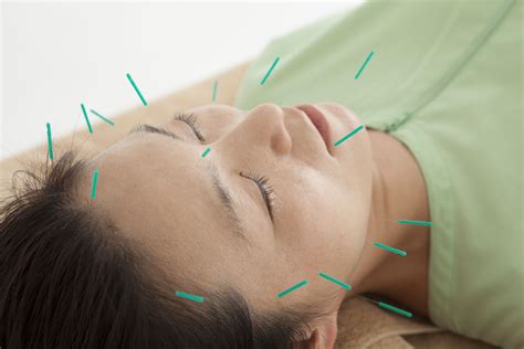 Acupuncture & Shiatsu at Triangle Therapies