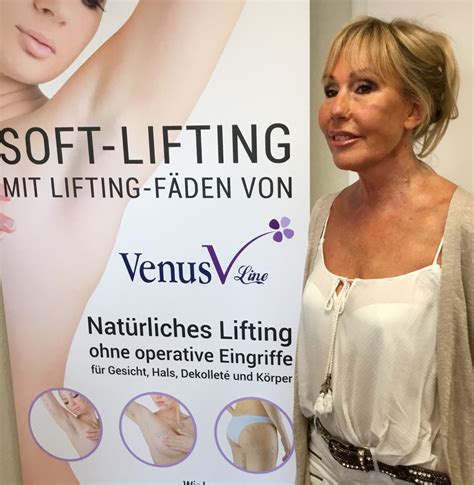 Aesthetic First für Facelift - Fadenlifting - Botox - Oberlidstraffung in Köln