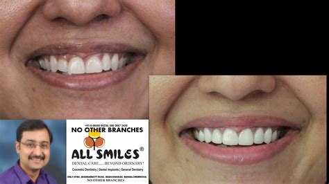 All Smiles Dental Clinic Haridwar