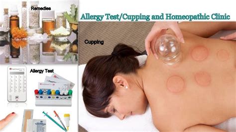 Allergy Test/Cupping & Homeopathic Clinic
