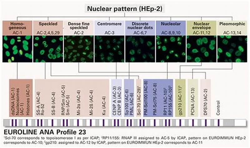 Ana 12 Plus Profile Homogeneous Pattern