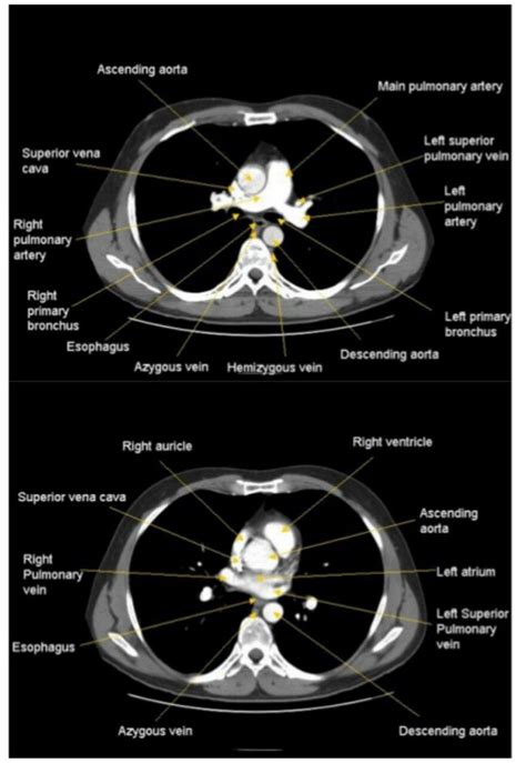 Axial View