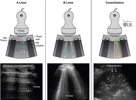 Probe Position