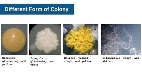 Bacterial Colony Color Comparison Chart Cream Buff White Yellow Tan
