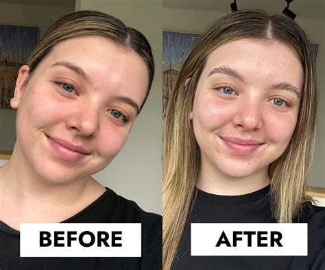 Before After