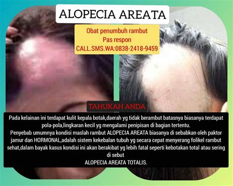 Botak Koin