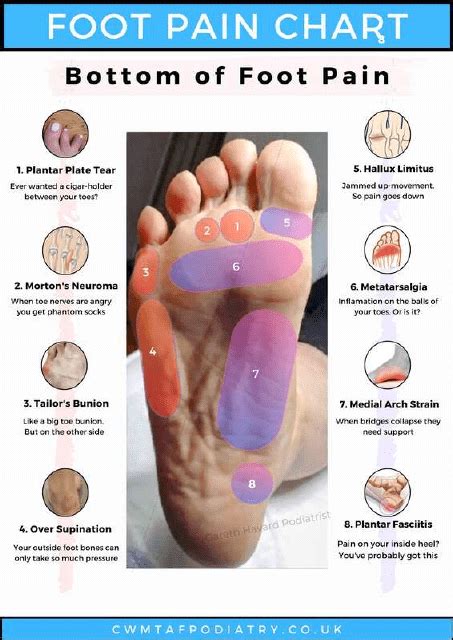 Bottom Foot Pain Chart