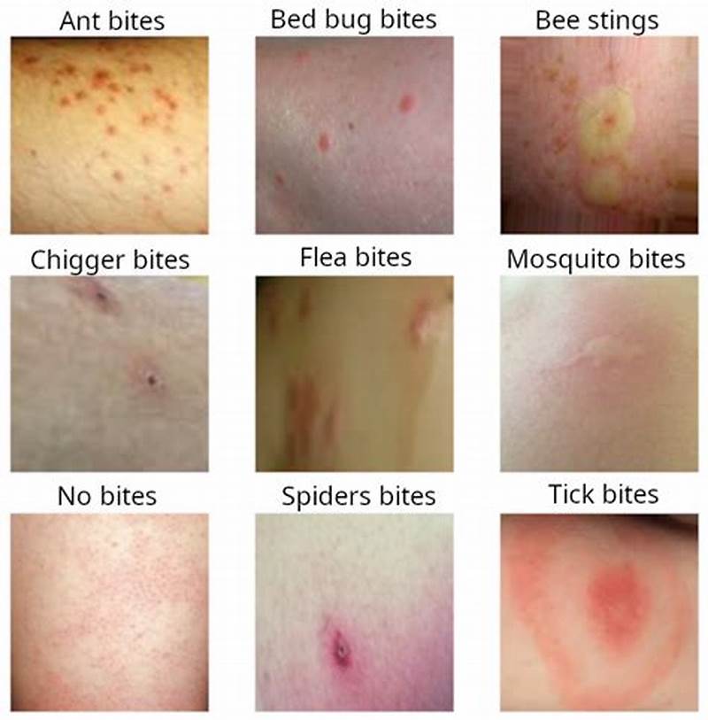 Bug Bite Pattern