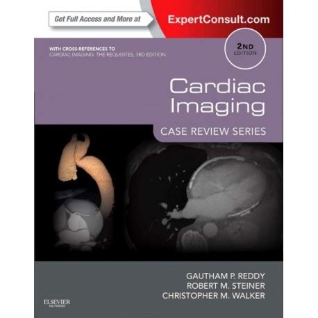 download Cardiac Imaging: Case Review Series E-Book